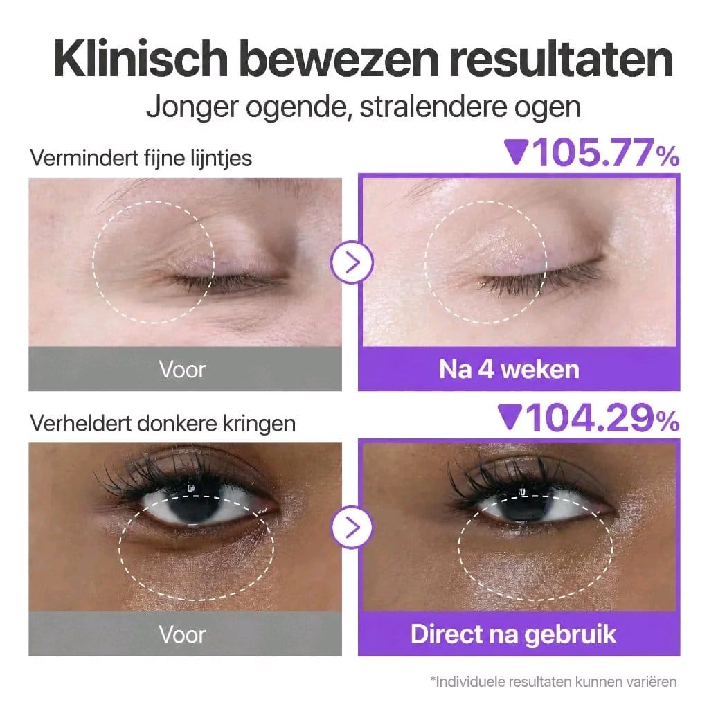 Numbuzin No.9 NAD+ Retinol Oogcrème Set met Zalm-PDRN - Verstevigend & Hydraterend
